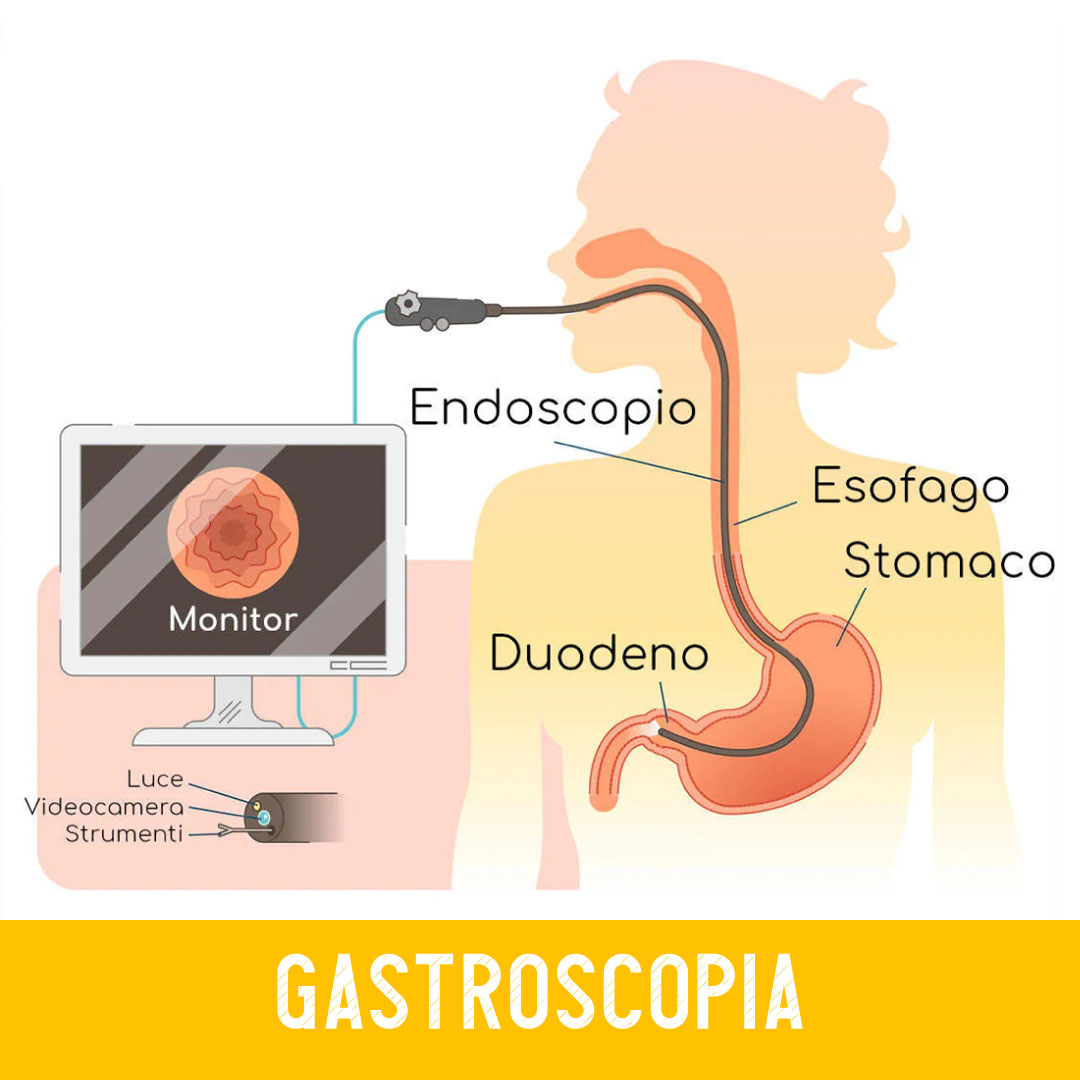 gastroscopia