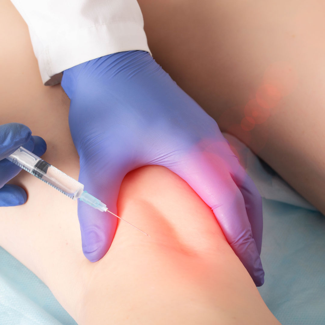 ozonoterapia a cosa serve