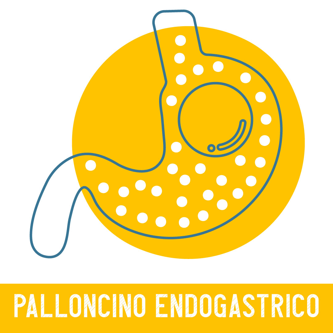 palloncino endogastrico palloncino endogastrico